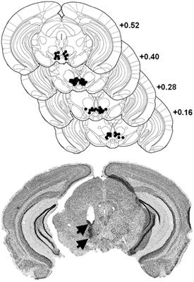 Morphine Reward Promotes Cue-Sensitive Learning: Implication of Dorsal Striatal CREB Activity